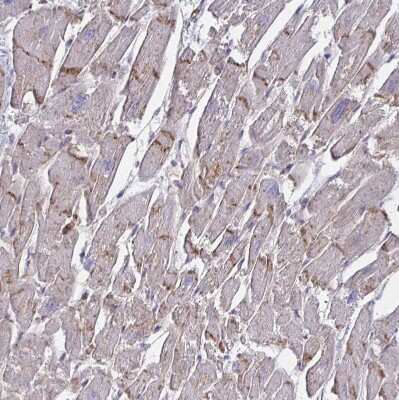 Immunohistochemistry-Paraffin: NHE6/SLC9A6 Antibody [NBP2-38877]