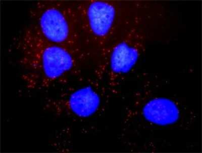 Proximity Ligation Assay: NHERF-1 Antibody (2B7) [H00009368-M02]