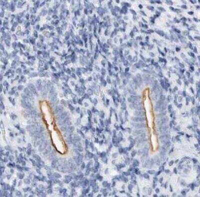 Immunohistochemistry-Paraffin: NHERF-1 Antibody [NBP1-84918]