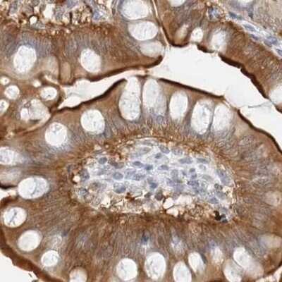 Immunohistochemistry-Paraffin: NHERF-1 Antibody [NBP1-84918]