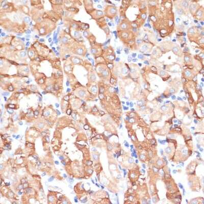 Immunohistochemistry-Paraffin: NHLRC1 Antibody - Azide and BSA Free [NBP2-94901]