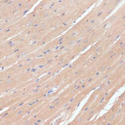 Immunohistochemistry-Paraffin: NHLRC1 Antibody - Azide and BSA Free [NBP2-94901]
