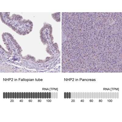 Immunohistochemistry-Paraffin: NHP2 Antibody [NBP2-13656]