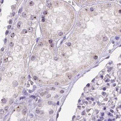 Immunohistochemistry-Paraffin: NHP2 Antibody [NBP2-13656]