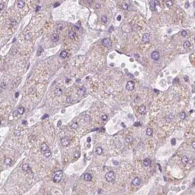 Immunohistochemistry-Paraffin: NHP2 Antibody [NBP2-13656]