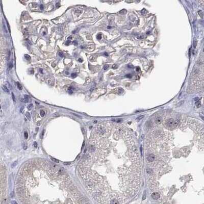 Immunohistochemistry-Paraffin: NHP2 Antibody [NBP2-38626]