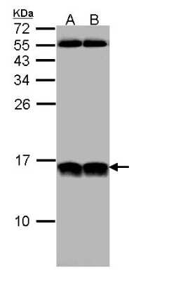 Western Blot: NHP2L1 Antibody [NBP1-32732]