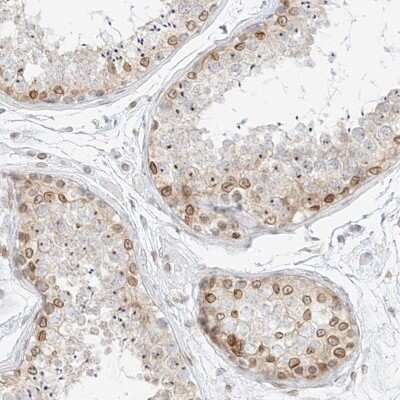 Immunohistochemistry-Paraffin: NHSL1 Antibody [NBP2-38148]