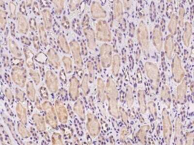 Immunohistochemistry-Paraffin: NICE-3 Antibody [NBP2-97389]