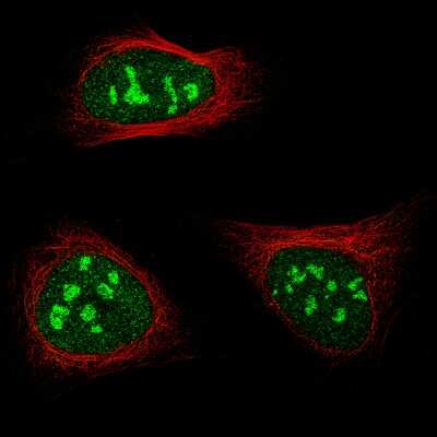 Immunocytochemistry/ Immunofluorescence: NIFK Antibody (CL2237) [NBP2-36750]