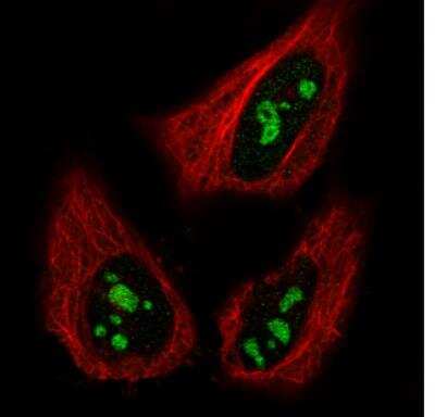 Immunocytochemistry/ Immunofluorescence: NIFK Antibody (CL2240) [NBP2-36749]