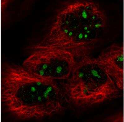 Immunocytochemistry/ Immunofluorescence: NIFK Antibody (CL2240) [NBP2-36749]