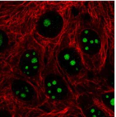 Immunocytochemistry/ Immunofluorescence: NIFK Antibody (CL2240) [NBP2-36749]