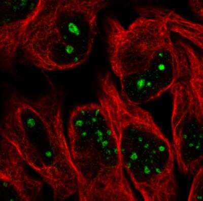 Immunocytochemistry/ Immunofluorescence: NIFK Antibody (CL2240) [NBP2-36749]