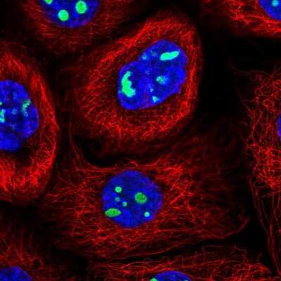 Immunocytochemistry/ Immunofluorescence: NIFK Antibody [NBP2-48642]