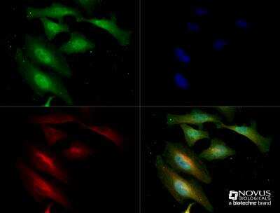 Immunocytochemistry/ Immunofluorescence: NIK/MAP3K14 Antibody [NB100-56367]
