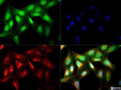Immunocytochemistry/ Immunofluorescence: NIK/MAP3K14 Antibody - BSA Free [NBP2-23603]