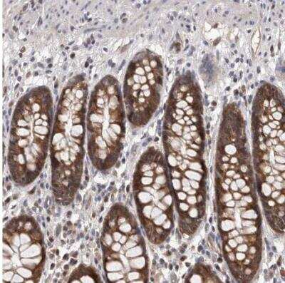 Immunohistochemistry-Paraffin: NIK/MAP3K14 Antibody [NBP1-83414]
