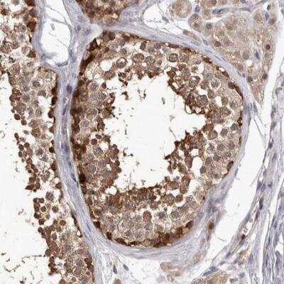 Immunohistochemistry-Paraffin: NIK/MAP3K14 Antibody [NBP1-83414]