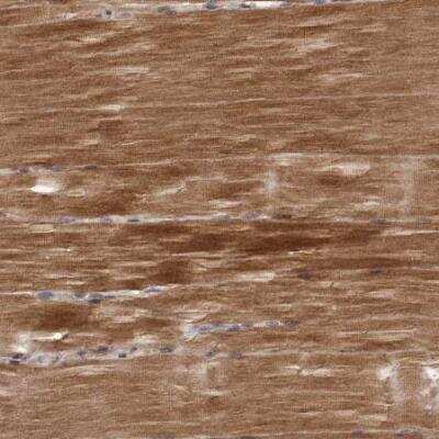 Immunohistochemistry-Paraffin: NIK/MAP3K14 Antibody [NBP1-83414]