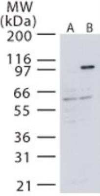 Western Blot: NIK/MAP3K14 Antibody [NB100-56367]