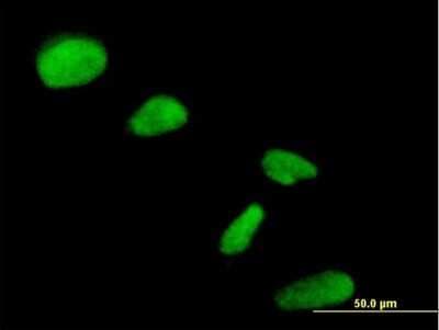 Immunocytochemistry/ Immunofluorescence: NIP30 Antibody [H00080011-B01P]