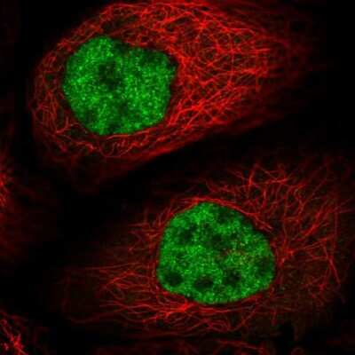 Immunocytochemistry/ Immunofluorescence: NIP30 Antibody [NBP2-13988]