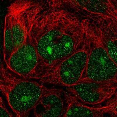 Immunocytochemistry/ Immunofluorescence: NIP7 Antibody [NBP2-58932]