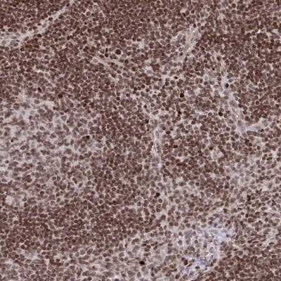 Immunohistochemistry-Paraffin: NIP7 Antibody [NBP2-31801]