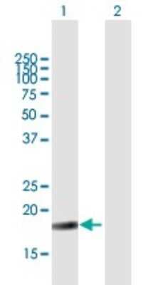 Western Blot: NIP7 Antibody [H00051388-B03P]