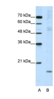 Western Blot: NIP7 Antibody [NBP1-57435]
