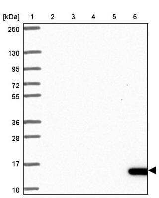 Western Blot: NIP7 Antibody [NBP2-31801]