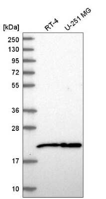 Western Blot: NIP7 Antibody [NBP2-58932]