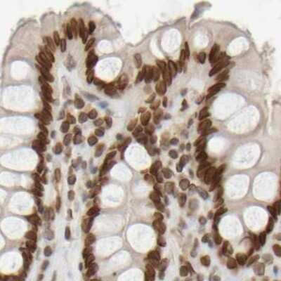 Immunohistochemistry-Paraffin: NIPA Antibody [NBP1-82564]