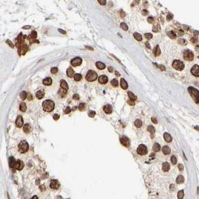 Immunohistochemistry-Paraffin: NIPA Antibody [NBP1-82564]