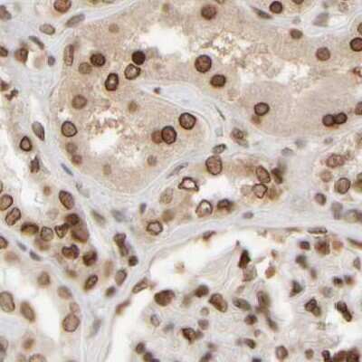 Immunohistochemistry-Paraffin: NIPA Antibody [NBP1-82564]