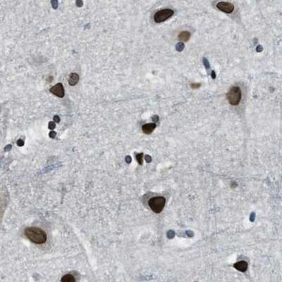 Immunohistochemistry-Paraffin: NIPA Antibody [NBP1-82565]