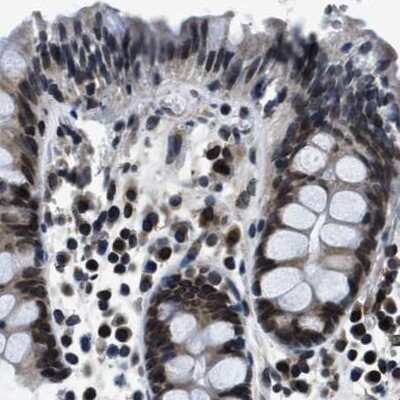 Immunohistochemistry-Paraffin: NIPA Antibody [NBP1-82565]
