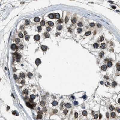 Immunohistochemistry-Paraffin: NIPA Antibody [NBP1-82565]