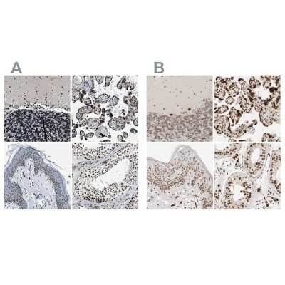 Immunohistochemistry-Paraffin: NIPA Antibody [NBP1-82565]