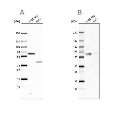 Western Blot: NIPA Antibody [NBP1-82564]