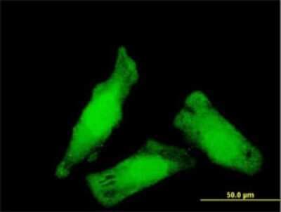Immunocytochemistry/ Immunofluorescence: NIPBL Antibody (3B9) [H00025836-M01]