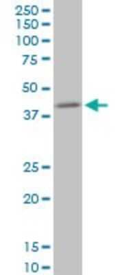 Western Blot: NIPP1 Antibody (1G11) [H00005511-M21]