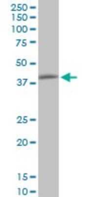 Western Blot: NIPP1 Antibody (1G11) [H00005511-M21]