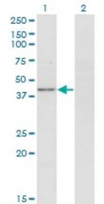 Western Blot: NIPP1 Antibody (4B5) [H00005511-M05]