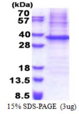 SDS-PAGE: Recombinant Human NIPSNAP1 His Protein [NBP2-23289]