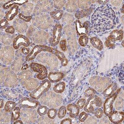 Immunohistochemistry: NIPSNAP3A Antibody [NBP2-46674]