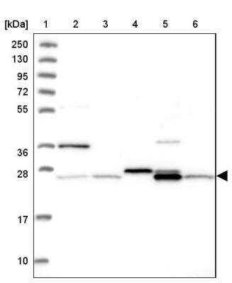 Western Blot: NIPSNAP3A Antibody [NBP2-46674]