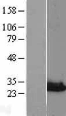 Western Blot: NIPSNAP3A Overexpression Lysate [NBL1-13646]