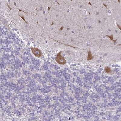Immunohistochemistry-Paraffin: NIR2 Antibody [NBP2-34132]